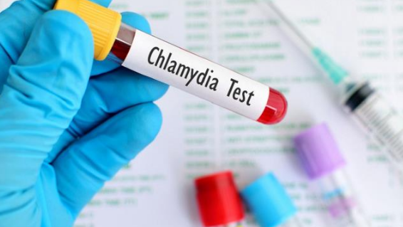 Xét nghiệm bệnh chlamydia ở đâu chính xác, nhanh chóng